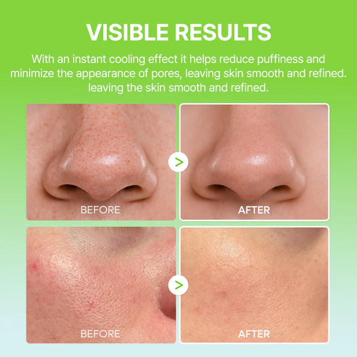 Cactiqᶜᵗ |  PORE RELIEF MULTI BALM with Cactus Cooling To Reduce Puffiness